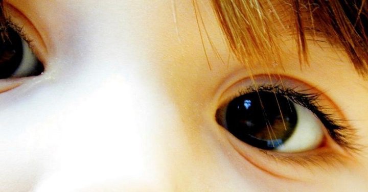 Beware Of Lazy Eye Syndrome In Children Beware Of Lazy Eye Syndrome In Children