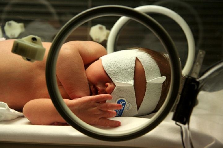 New-Born Jaundice: Causes, Symptoms And Treatment New-Born Jaundice: Causes, Symptoms And Treatment